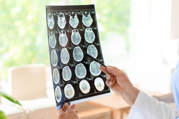 Neurology