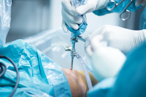 Orthopedic Surgery